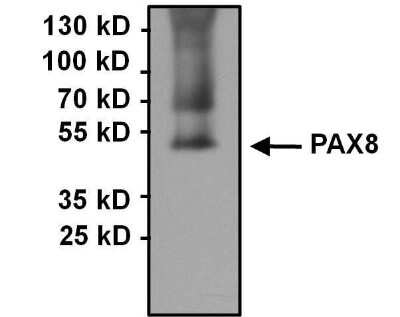 Immunoprecipitation: PAX8 Antibody [NBP2-29907]