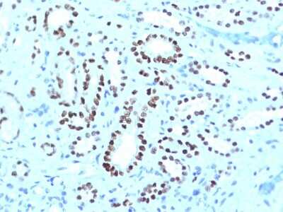 Immunohistochemistry-Paraffin: PAX8 Antibody (PAX8/1491 + PAX8/1492) - Azide and BSA Free [NBP3-08274]