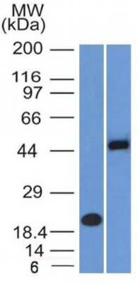 Western Blot: PAX8 Antibody (PAX8/1491 + PAX8/1492) [NBP3-07355]