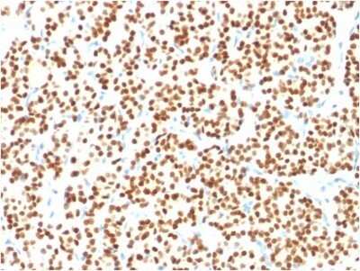 Immunohistochemistry-Paraffin: PAX8 Antibody (PAX8/1491) - Azide and BSA Free [NBP2-54486]