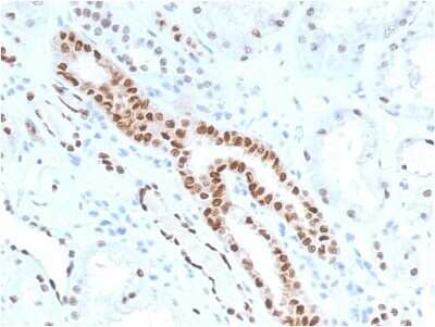 Immunohistochemistry-Paraffin: PAX8 Antibody (PAX8/1491) - Azide and BSA Free [NBP2-54486]