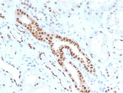 Immunohistochemistry-Paraffin: PAX8 Antibody (PAX8/1491) [NBP2-53260]