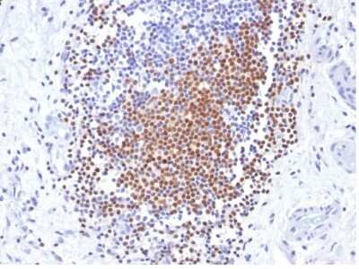 Immunohistochemistry-Paraffin: PAX8 Antibody (PAX8/1492) - Azide and BSA Free [NBP2-54539]