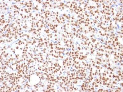 Immunohistochemistry-Paraffin: PAX8 Antibody (PAX8/1492) [NBP2-53371]