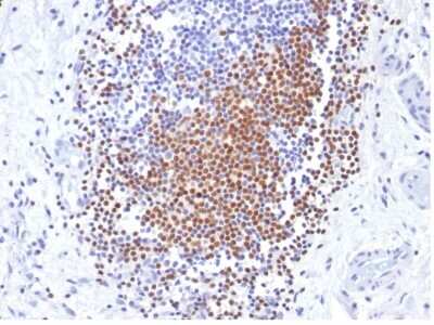 Immunohistochemistry-Paraffin: PAX8 Antibody (PAX8/1492) [NBP2-53371]