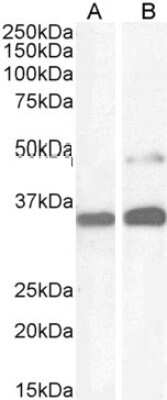 Western Blot: PAX8 Antibody [NB100-1065]