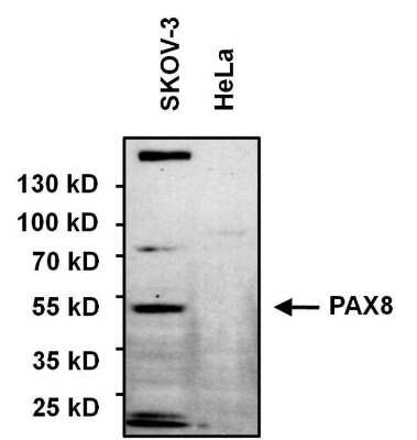 Western Blot: PAX8 Antibody [NBP2-29907]