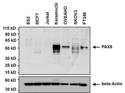 Western Blot: PAX8 Antibody [NBP2-29907]