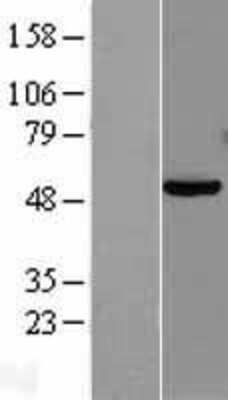 Western Blot: PAX8 Overexpression Lysate [NBL1-14132]