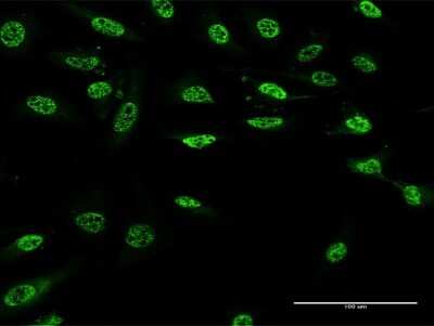 Immunocytochemistry/ Immunofluorescence: PAX9 Antibody (3B8) [H00005083-M13]