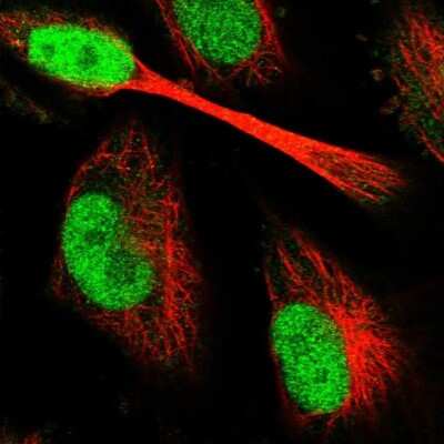 Immunocytochemistry/ Immunofluorescence: PAXX Antibody [NBP1-94172]