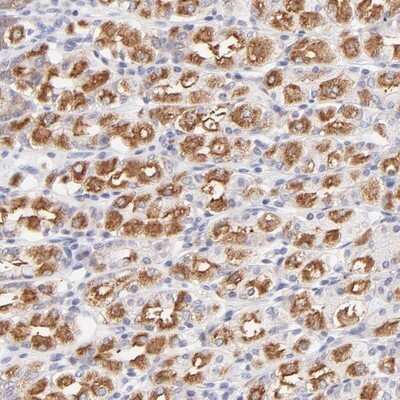 Immunohistochemistry-Paraffin: PBDC1 Antibody [NBP1-82657]