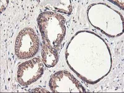 Immunohistochemistry: PBDC1 Antibody (OTI4E11) - Azide and BSA Free [NBP2-71912]