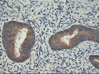 Immunohistochemistry: PBDC1 Antibody (OTI4E11) - Azide and BSA Free [NBP2-71912]