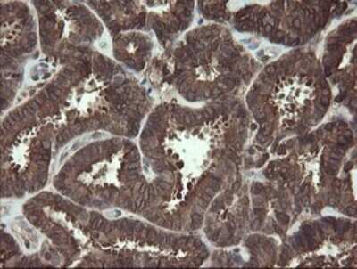 Immunohistochemistry: PBDC1 Antibody (OTI5A11) - Azide and BSA Free [NBP2-71911]