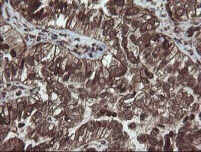 Immunohistochemistry: PBDC1 Antibody (OTI5A11) - Azide and BSA Free [NBP2-71911]