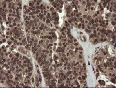 Immunohistochemistry: PBDC1 Antibody (OTI5A11) - Azide and BSA Free [NBP2-71911]