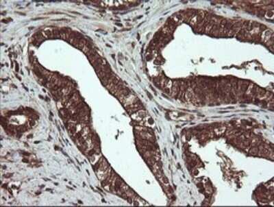 Immunohistochemistry: PBDC1 Antibody (OTI5A11) - Azide and BSA Free [NBP2-71911]