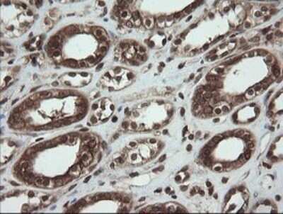 Immunohistochemistry: PBDC1 Antibody (OTI5A11) - Azide and BSA Free [NBP2-71911]