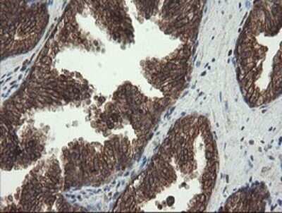 Immunohistochemistry: PBDC1 Antibody (OTI5A11) - Azide and BSA Free [NBP2-71911]