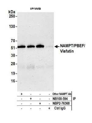 Immunoprecipitation: PBEF/Visfatin/NAMPT Antibody (BLR058F) [NBP2-76368]