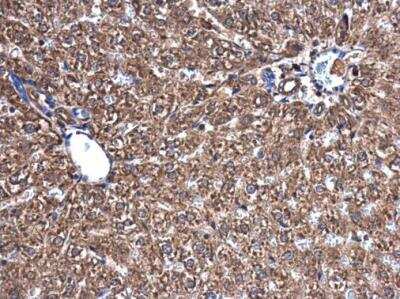 Immunohistochemistry-Paraffin: PBEF/Visfatin/NAMPT Antibody [NBP2-19468]