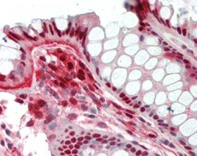 Immunohistochemistry-Paraffin: PBEF/Visfatin/NAMPT Antibody (OMNI379) - Azide and BSA Free [NBP2-80036]