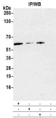 Western Blot: PBEF/Visfatin/NAMPT Antibody [NB100-594]