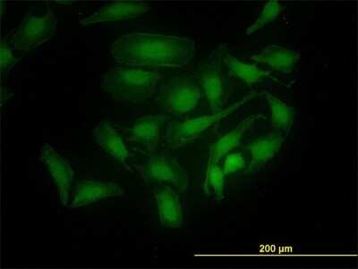 Immunocytochemistry/ Immunofluorescence: PBK Antibody (3A11) [H00055872-M11]