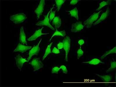 Immunocytochemistry/ Immunofluorescence: PBK Antibody (3A7) [H00055872-M07]