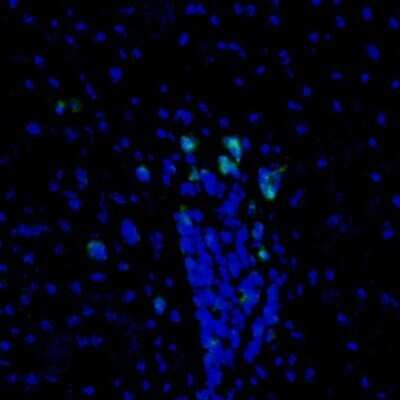 Immunohistochemistry: PBK Antibody [NBP1-84342]