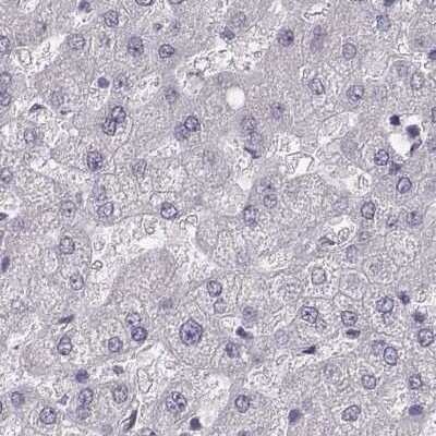 Immunohistochemistry-Paraffin: PBK Antibody [NBP1-84342]