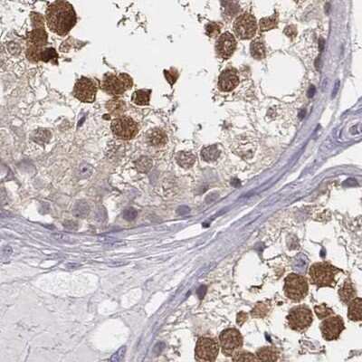 Immunohistochemistry-Paraffin: PBK Antibody [NBP1-84342]