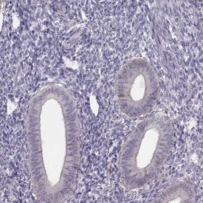 Immunohistochemistry-Paraffin: PBK Antibody [NBP2-58043]