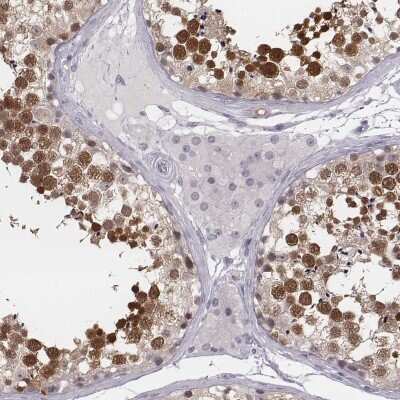 Immunohistochemistry-Paraffin: PBK Antibody [NBP2-58043]