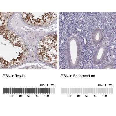 Immunohistochemistry-Paraffin: PBK Antibody [NBP2-58043]