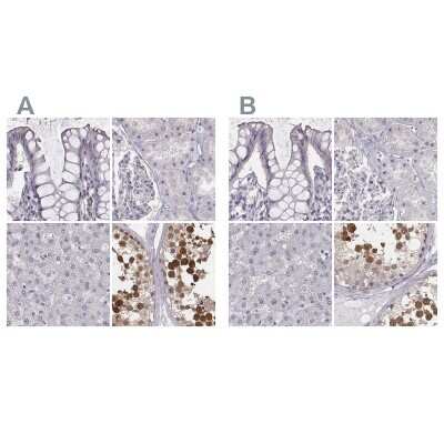 Immunohistochemistry-Paraffin: PBK Antibody [NBP2-58043]
