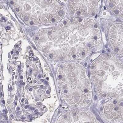 Immunohistochemistry-Paraffin: PBK Antibody [NBP2-58043]