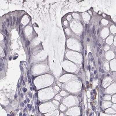 Immunohistochemistry-Paraffin: PBK Antibody [NBP2-58043]