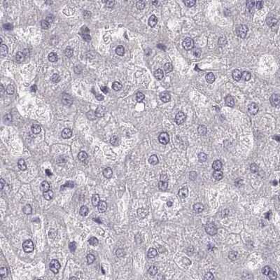 Immunohistochemistry-Paraffin: PBK Antibody [NBP2-58043]