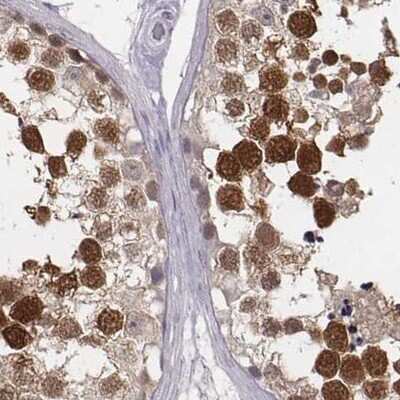 Immunohistochemistry-Paraffin: PBK Antibody [NBP2-58043]