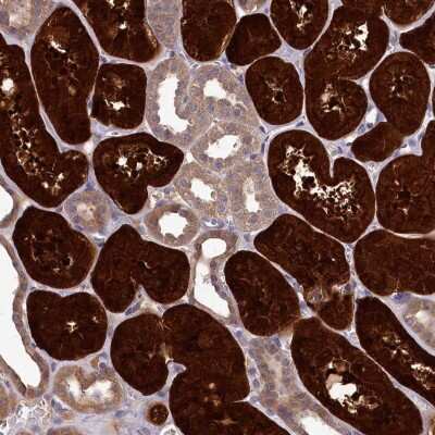 Immunohistochemistry-Paraffin: PBLD Antibody [NBP1-83682]