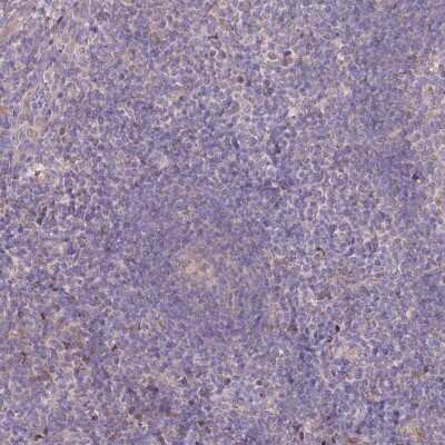 Immunohistochemistry-Paraffin: PBLD Antibody [NBP1-83682]