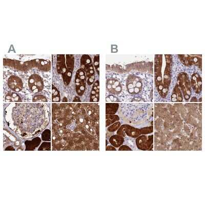 Immunohistochemistry-Paraffin: PBLD Antibody [NBP1-83682]