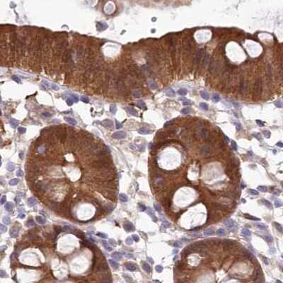 Immunohistochemistry-Paraffin: PBLD Antibody [NBP1-83682]