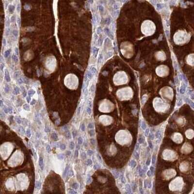 Immunohistochemistry-Paraffin: PBLD Antibody [NBP1-83682]