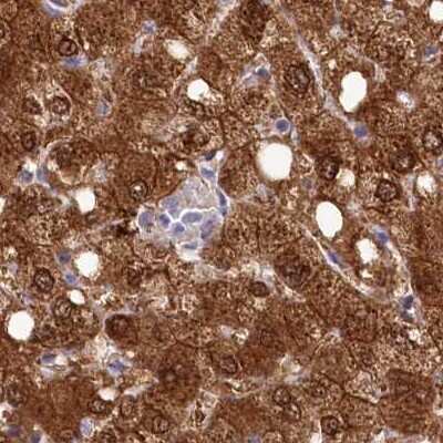 Immunohistochemistry-Paraffin: PBLD Antibody [NBP1-83682]