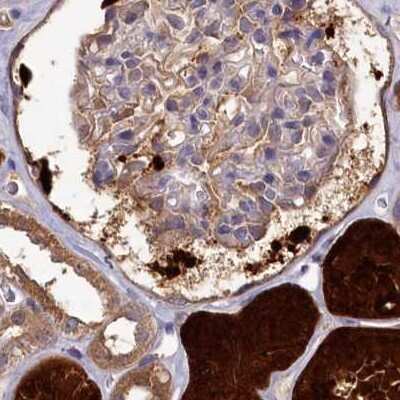 Immunohistochemistry-Paraffin: PBLD Antibody [NBP1-83682]