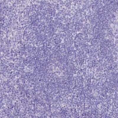 Immunohistochemistry-Paraffin: PBLD Antibody [NBP1-83683]