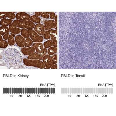 Immunohistochemistry-Paraffin: PBLD Antibody [NBP1-83683]